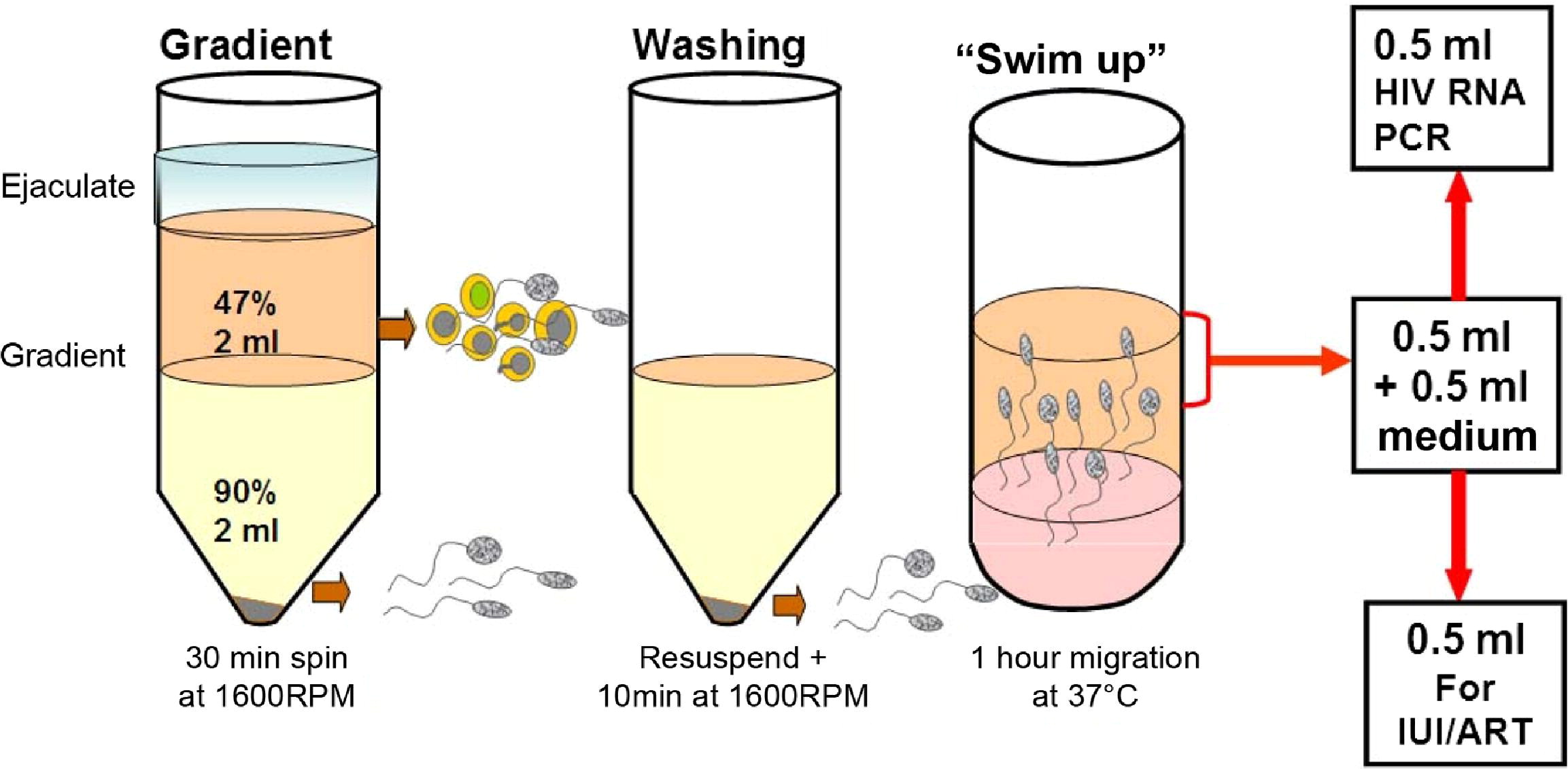 sperm-washing-to-help-hiv-discordant-couples-conceive-biological